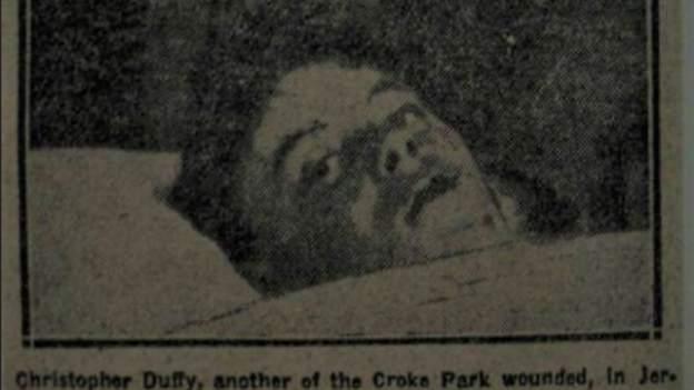 Christopher 'Yarra' Duffy pictured in Jervis Street Hospital after being shot in the neck on Bloody Sunday. 