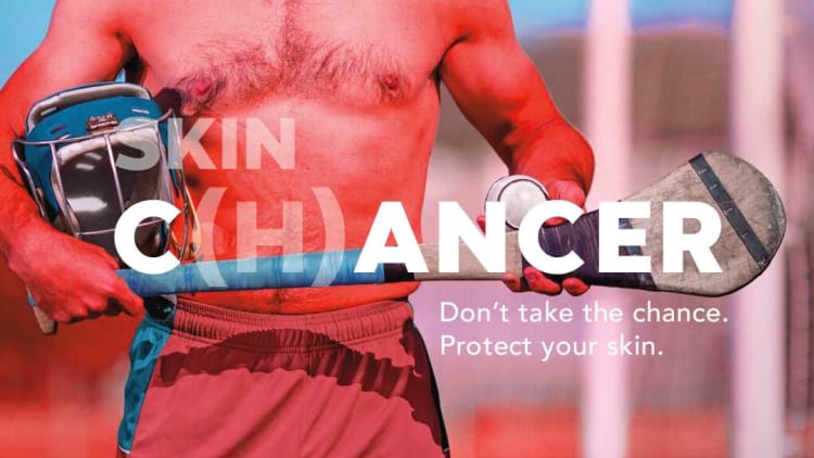 The GAA have teamed up with the Marie Keating Foundation, an official GAA charity for 2019, to promote their ‘Skin C(h)ancer’ campaign.